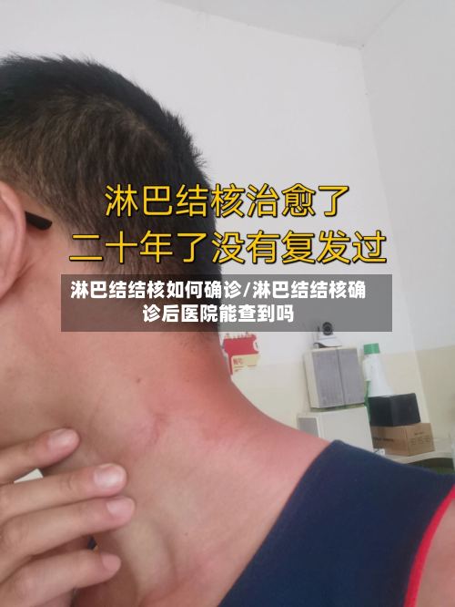 淋巴结结核如何确诊/淋巴结结核确诊后医院能查到吗