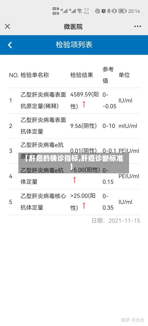 【肝癌的确诊指标,肝癌诊断标准】