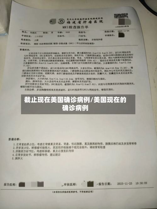 截止现在美国确诊病例/美国现在的确诊病例-第2张图片