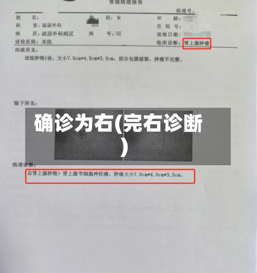 确诊为右(完右诊断)-第3张图片