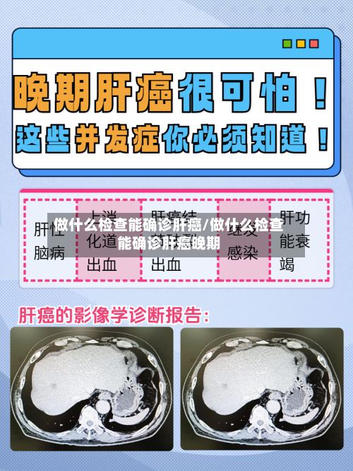 做什么检查能确诊肝癌/做什么检查能确诊肝癌晚期-第2张图片