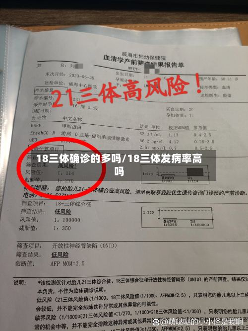 18三体确诊的多吗/18三体发病率高吗-第2张图片