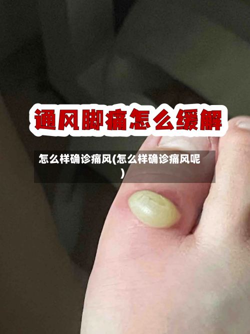 怎么样确诊痛风(怎么样确诊痛风呢)-第2张图片