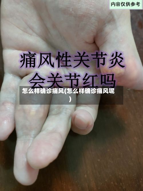 怎么样确诊痛风(怎么样确诊痛风呢)