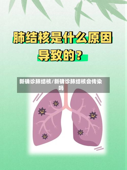 新确诊肺结核/新确诊肺结核会传染吗-第3张图片