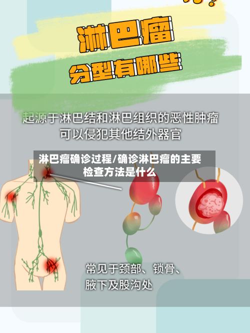 淋巴瘤确诊过程/确诊淋巴瘤的主要检查方法是什么-第2张图片