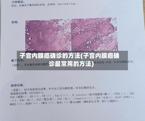 子宫内膜癌确诊的方法(子宫内膜癌确诊最常用的方法)