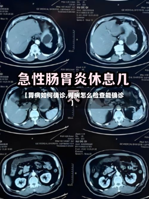 【胃病如何确诊,胃病怎么检查能确诊】-第2张图片