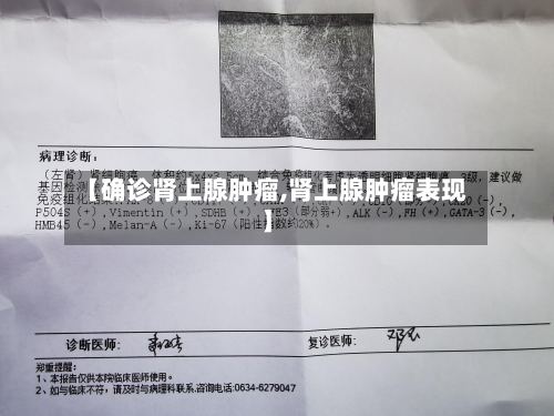 【确诊肾上腺肿瘤,肾上腺肿瘤表现】-第2张图片