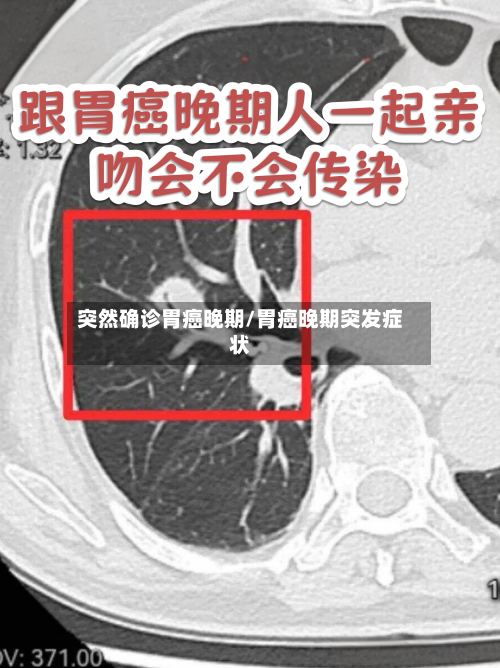 突然确诊胃癌晚期/胃癌晚期突发症状