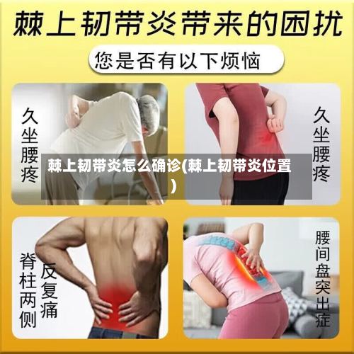 棘上韧带炎怎么确诊(棘上韧带炎位置)