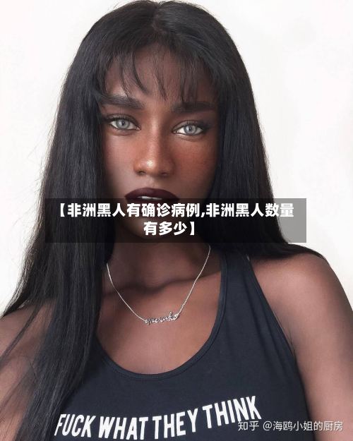 【非洲黑人有确诊病例,非洲黑人数量有多少】-第2张图片