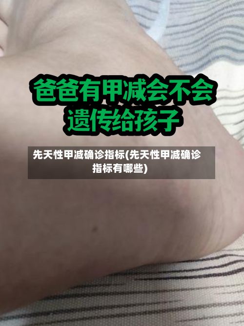 先天性甲减确诊指标(先天性甲减确诊指标有哪些)