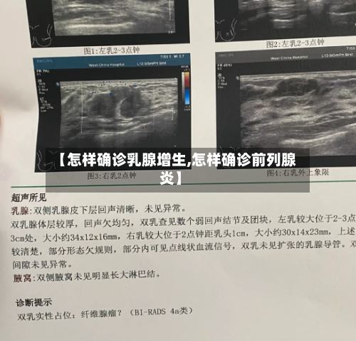 【怎样确诊乳腺增生,怎样确诊前列腺炎】-第2张图片
