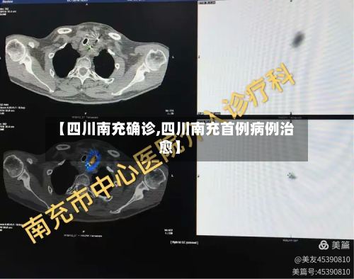 【四川南充确诊,四川南充首例病例治愈】-第2张图片