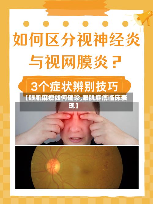 【眼肌麻痹如何确诊,眼肌麻痹临床表现】