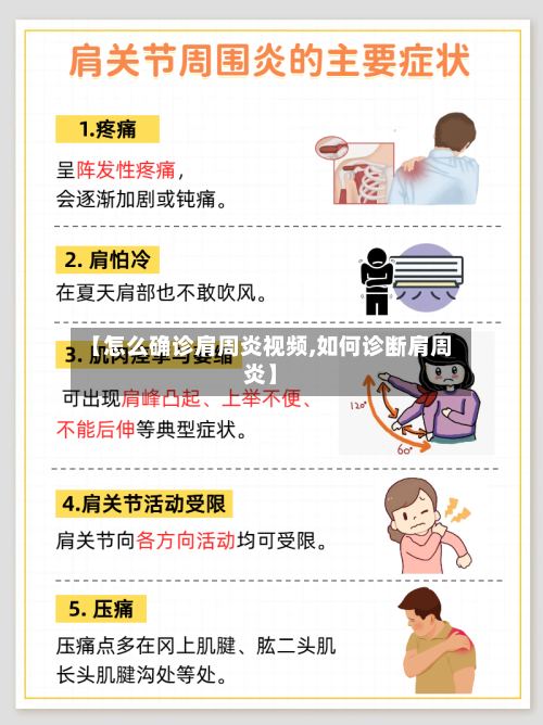 【怎么确诊肩周炎视频,如何诊断肩周炎】-第2张图片