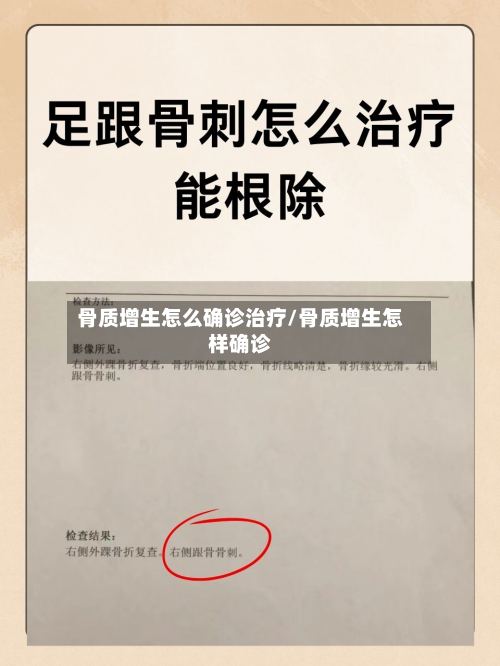骨质增生怎么确诊治疗/骨质增生怎样确诊