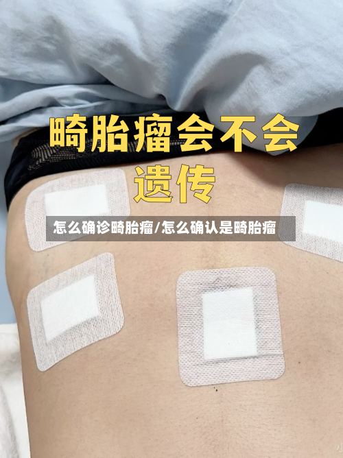 怎么确诊畸胎瘤/怎么确认是畸胎瘤