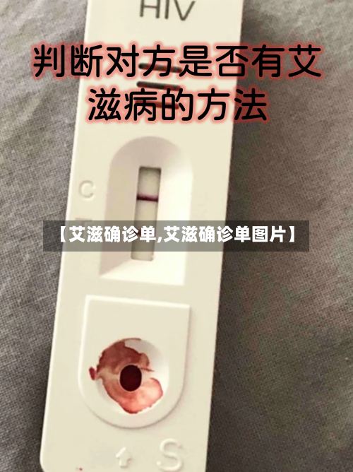 【艾滋确诊单,艾滋确诊单图片】
