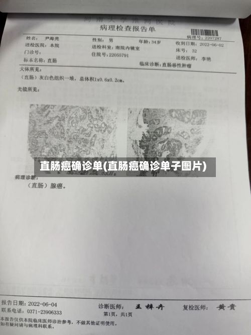 直肠癌确诊单(直肠癌确诊单子图片)