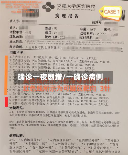 确诊一夜剧增/一确诊病例-第2张图片