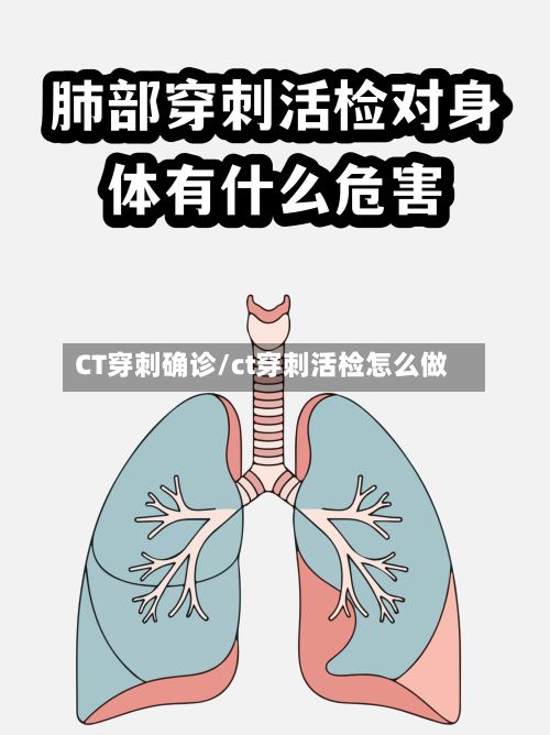 CT穿刺确诊/ct穿刺活检怎么做-第2张图片
